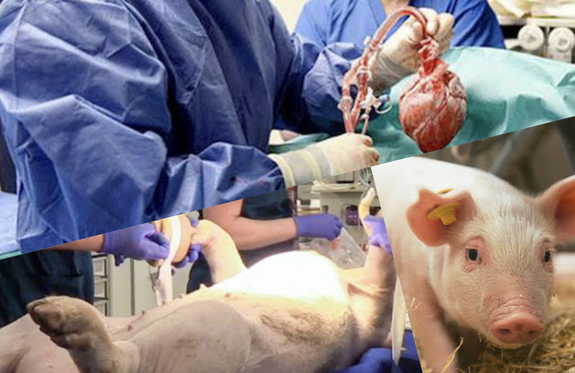 u-s-doctors-perform-pig-to-human-heart-transplants-daily-review